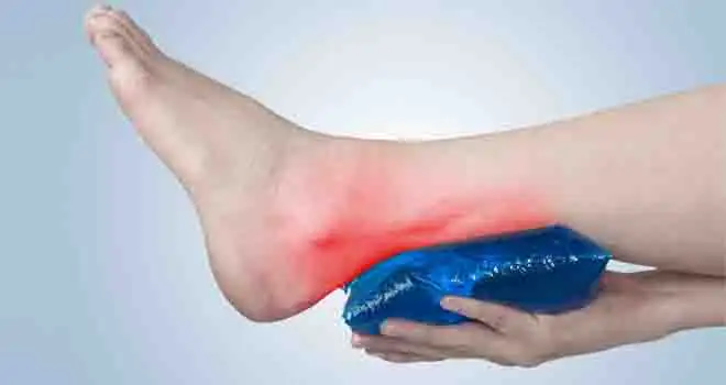 Achilles Tendon Rupture