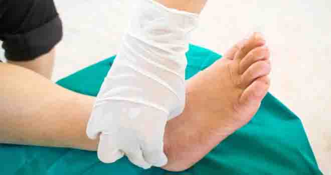 Ankle Ligament Reconstruction