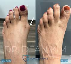 Diabetic Foot Care Before After